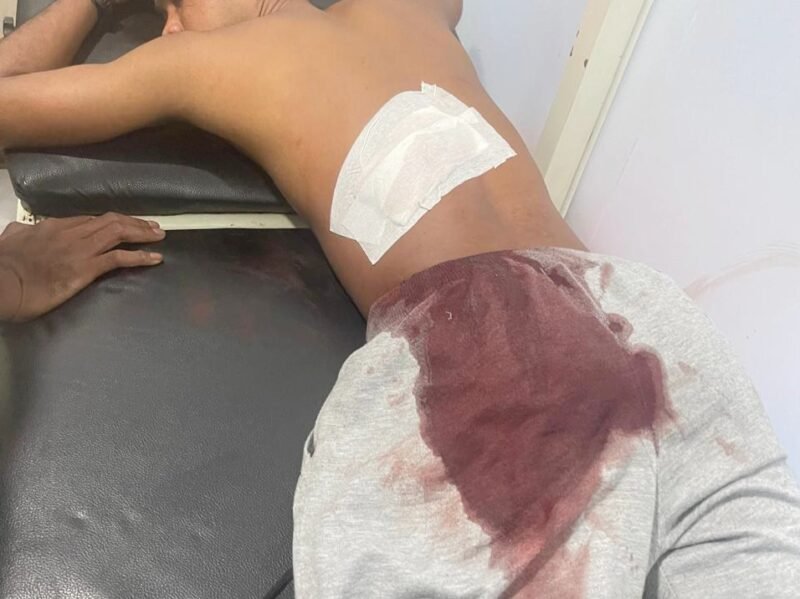 Korban perkelahian di Ternate Selatan saat di rawat di Rumah Sakit Chasan Boesoirie || dok : kasedata
