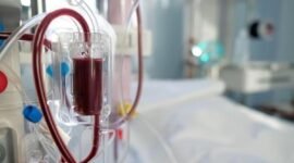 Foto : ilustrasi cuci darah 