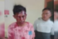 Irsandi Lukman (merah), warga Kelurahan Rua, Kecamatan Pulau Ternate diduga menjadi korban pengeroyokan [Foto : haerun/kasedata]