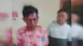 Irsandi Lukman (merah), warga Kelurahan Rua, Kecamatan Pulau Ternate diduga menjadi korban pengeroyokan [Foto : haerun/kasedata]