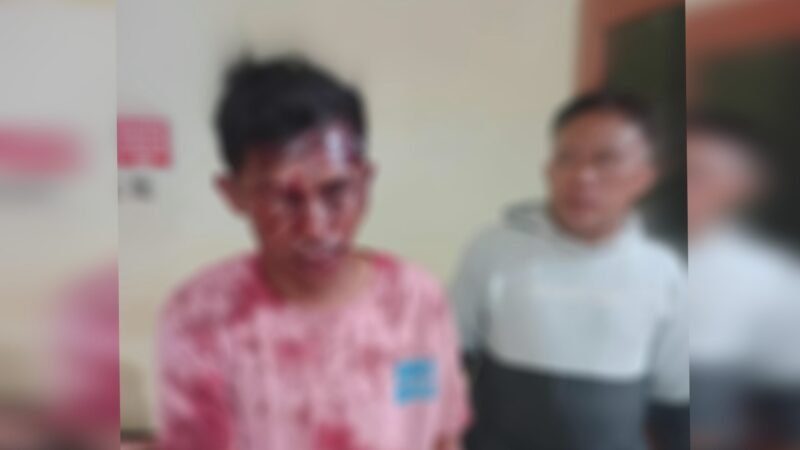Irsandi Lukman (merah), warga Kelurahan Rua, Kecamatan Pulau Ternate diduga menjadi korban pengeroyokan [Foto : haerun/kasedata]